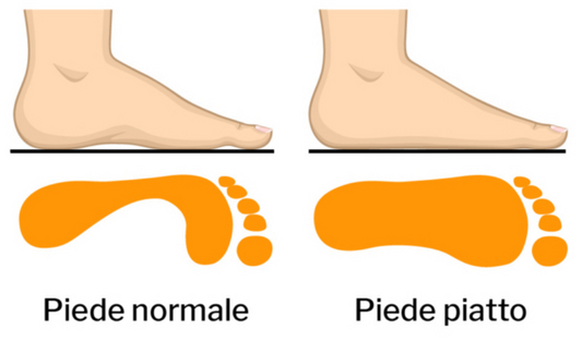 Piede Piatto: Plantare e Trattamento